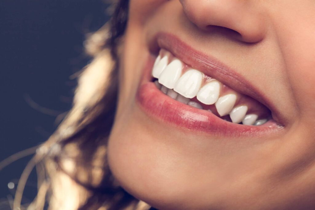 Clareamento Dental