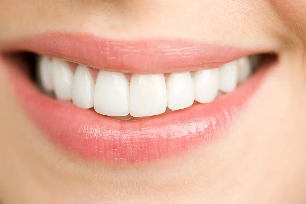 Implantes Dentários - miniatura 3